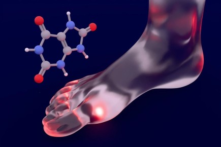 Станьте на путь к здоровым суставам: простые шаги к избавлению от мочевой кислоты